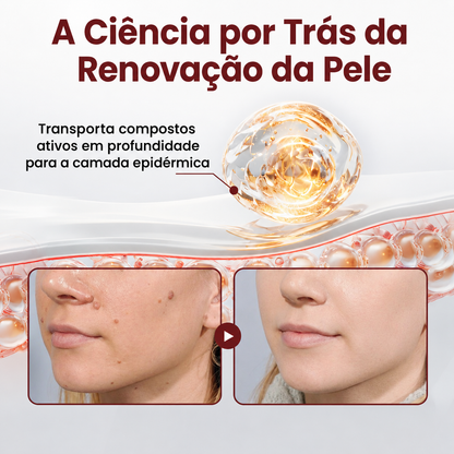 👩‍⚕️🌱𝑫𝑨𝑨𝑴𝒀® KeraErase Creme Renovador de Dupla Ação