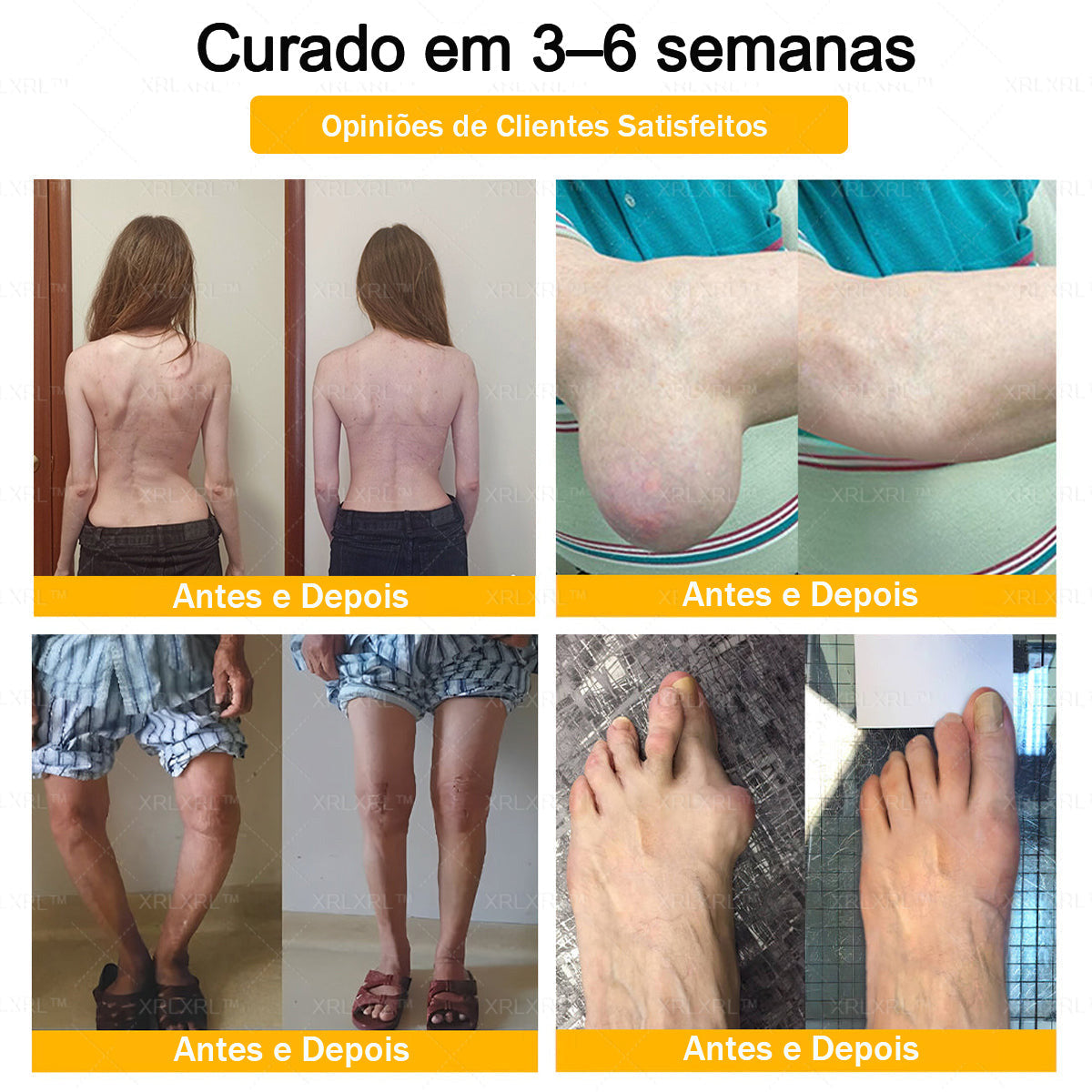 XRLXRL® Creme Reparador Ósseo e Alívio da Dor com Veneno de Abelha (Especialmente desenvolvido para pessoas idosas)
